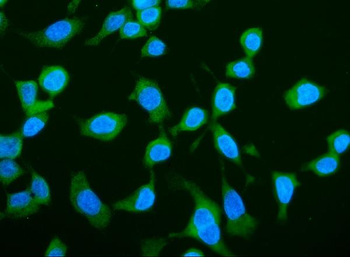 LARP1 Rabbit Polyclonal Antibody