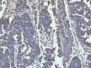 LARP1 Rabbit Polyclonal Antibody