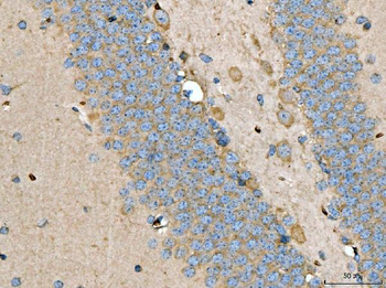 LARP1 Rabbit Polyclonal Antibody