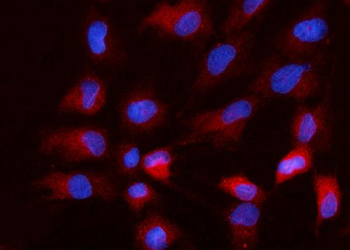 Nanog Rabbit Polyclonal Antibody