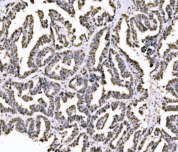 PIWIL4/PIWI Rabbit Polyclonal Antibody