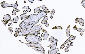 PIWIL4/PIWI Rabbit Polyclonal Antibody