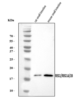 REG1A/1B Rabbit Polyclonal Antibody