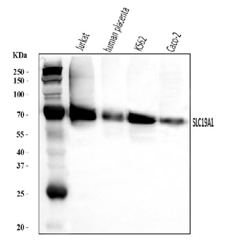 RFC/SLC19A1 Rabbit Polyclonal Antibody
