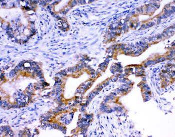 Stanniocalcin 1/STC/STC1 Rabbit Polyclonal Antibody