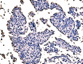 splicing factor 1 Antibody (monoclonal, 7D9E3)