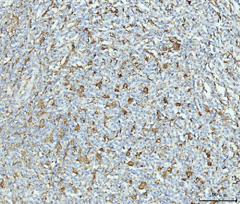 Grp75 Mouse Monoclonal Antibody