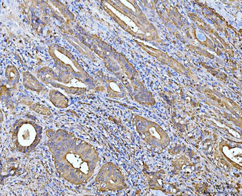ALDH1A1 Mouse Monoclonal Antibody