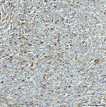 ALDH1A1 Mouse Monoclonal Antibody