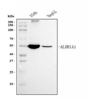 ALDH1A1 Mouse Monoclonal Antibody