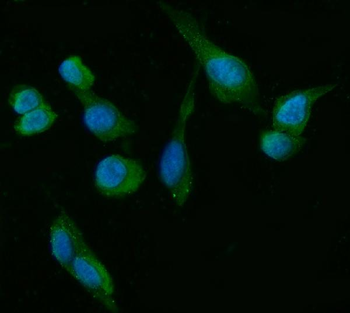 HSD3B1 Mouse Monoclonal Antibody
