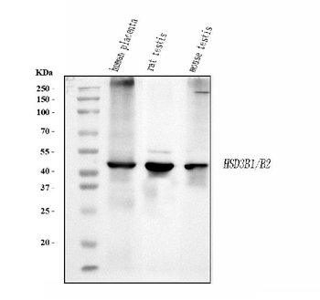 HSD3B1 Mouse Monoclonal Antibody