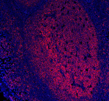 CD20/MS4A1 Antibody (monoclonal, 4I11)