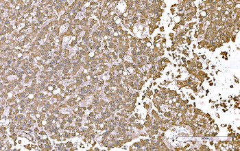 SND1 Mouse Monoclonal Antibody