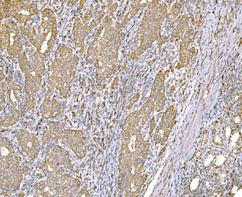 SND1 Mouse Monoclonal Antibody