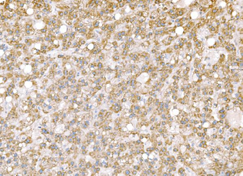 SND1 Mouse Monoclonal Antibody