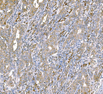 SND1 Mouse Monoclonal Antibody