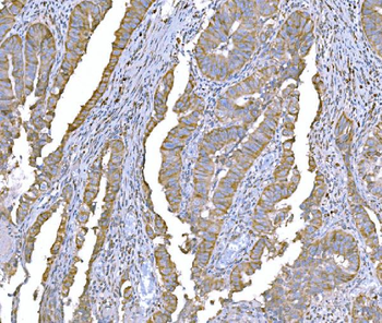 SND1 Mouse Monoclonal Antibody
