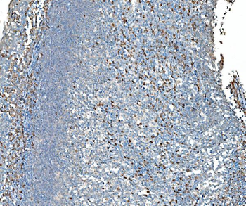 SND1 Mouse Monoclonal Antibody