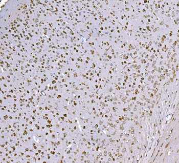 SND1 Mouse Monoclonal Antibody