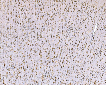 SND1 Mouse Monoclonal Antibody