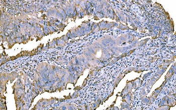 Prothrombin Mouse Monoclonal Antibody