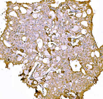 Prothrombin Mouse Monoclonal Antibody