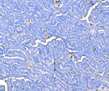 Prothrombin Mouse Monoclonal Antibody