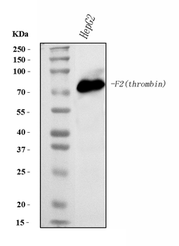 Prothrombin Mouse Monoclonal Antibody