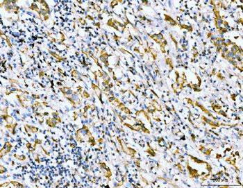 Filamin B/FLNB Antibody (monoclonal, 11E2D2)