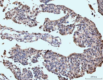 Neurofibromin/NF1 Antibody (monoclonal, 4C6F10)