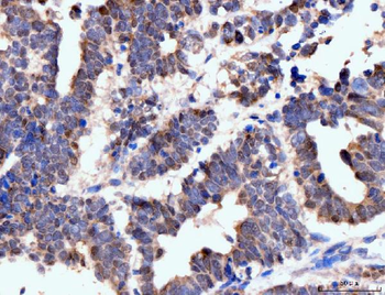 Neurofibromin/NF1 Antibody (monoclonal, 4C6F10)