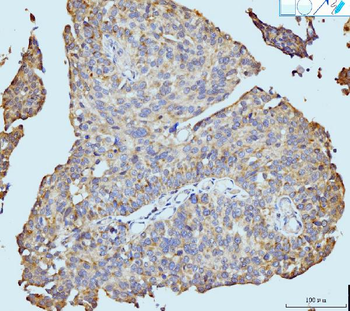 Neurofibromin/NF1 Antibody (monoclonal, 4F8B7)