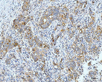 Neurofibromin/NF1 Antibody (monoclonal, 4F8B7)