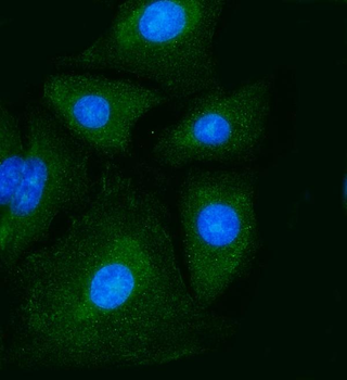PKM2 Mouse Monoclonal Antibody