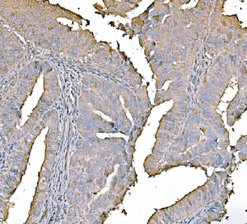 PKM2 Mouse Monoclonal Antibody