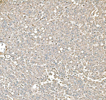 PKM2 Mouse Monoclonal Antibody