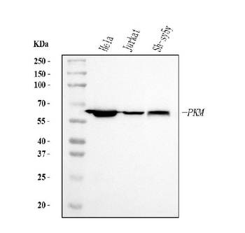 PKM2 Mouse Monoclonal Antibody