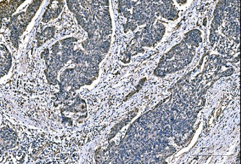 DYNLL1/PIN Mouse Monoclonal Antibody