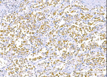 RALBP1 Antibody (monoclonal, 2F9D3)