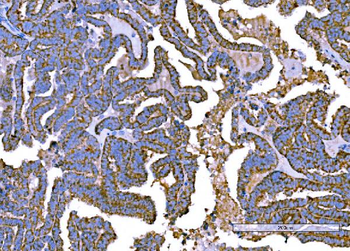 RALBP1 Antibody (monoclonal, 2F9D3)
