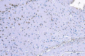 RALBP1 Antibody (monoclonal, 2F9D3)