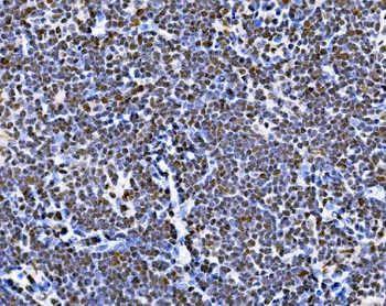 BUB1 Rabbit Polyclonal Antibody