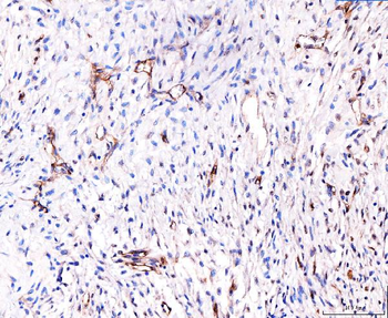CD93 Antibody