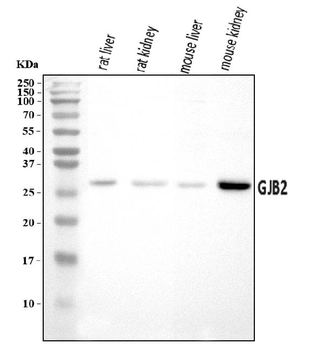 GJB2 Rabbit Polyclonal Antibody
