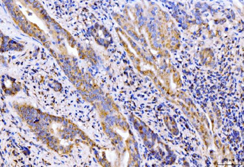 Giantin/GOLGB1 Rabbit Polyclonal Antibody