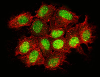 Nac1/NACC1 Rabbit Polyclonal Antibody