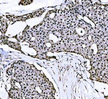 Nac1/NACC1 Rabbit Polyclonal Antibody