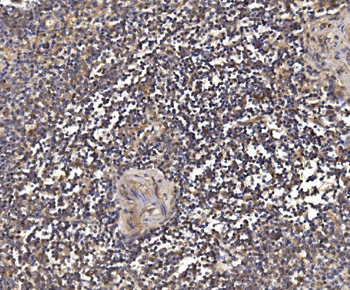 PSMD8 Rabbit Polyclonal Antibody