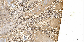 PSMD8 Rabbit Polyclonal Antibody